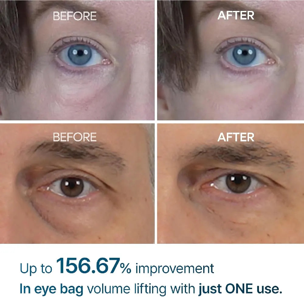 Dr Melaxin - Eyephalt Eyecream