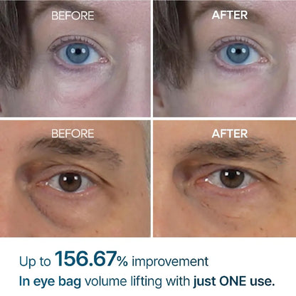 Dr Melaxin - Eyephalt Eyecream